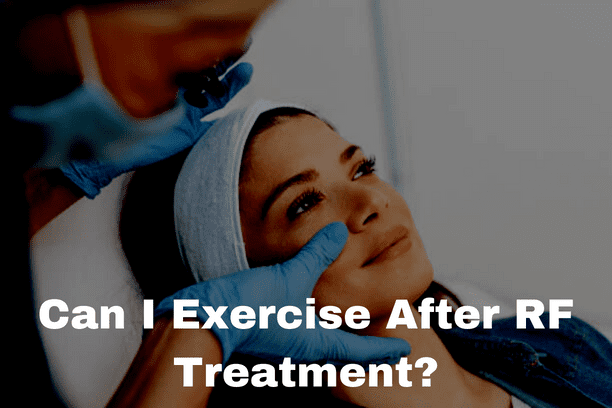 Can I Exercise After RF Treatment?